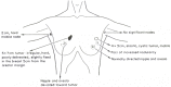 图176.2：。乳房检查可能发现的异常。