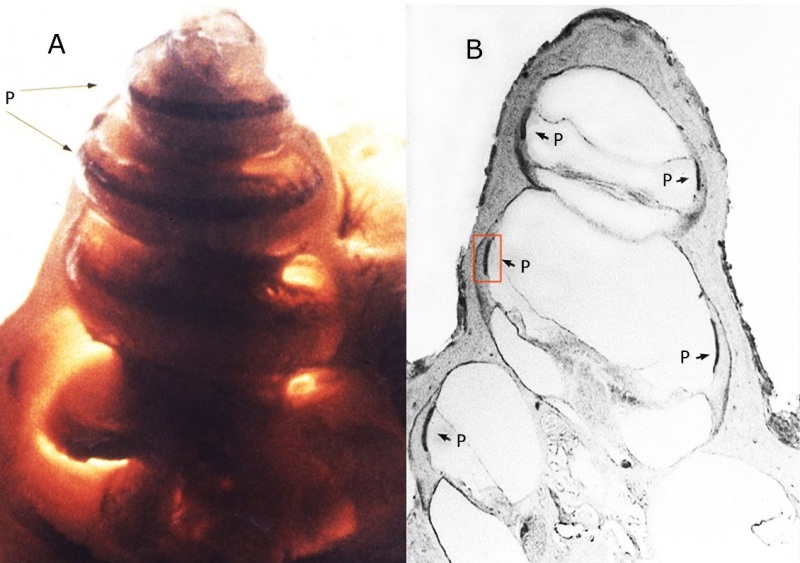 Figure 22. . Decalcified guinea pig cochlea (A) and sagittal section (B) through a guinea pig cochlea show deposition of melanin pigment (P) in stria vascularis Red boxed area enlarged in Figure 23.