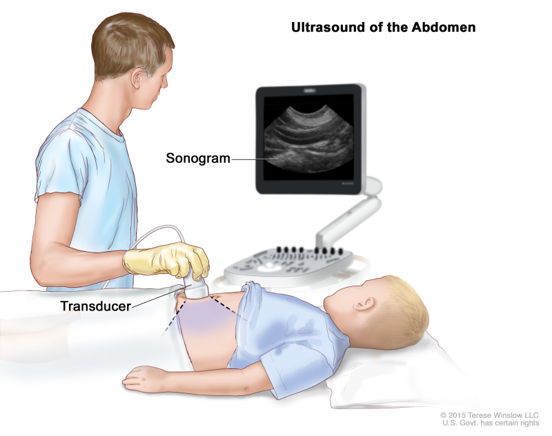 sonogram abdomen