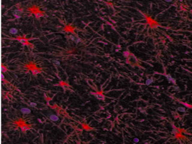 Figure, Astrocytes Image courtesy O.Chaigasame] - StatPearls