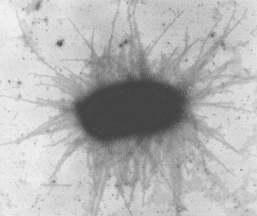 FIGURE 37.3.. Escherichia coli express hundreds of pili, as indicated by the fine filaments extending from the bacterium.