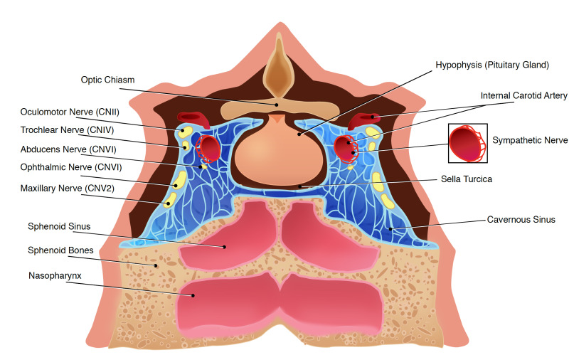 Figure, Cavernous Sinus Anatomy Cavernous Sinus] - StatPearls 