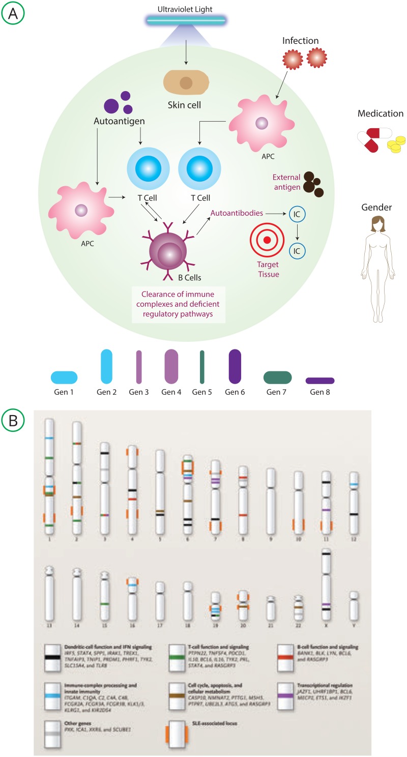 Figure Systemic Lupus Erythematosus Statpearls Ncbi B