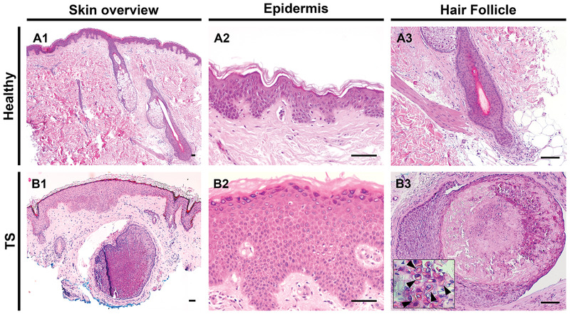 hair follicle histology