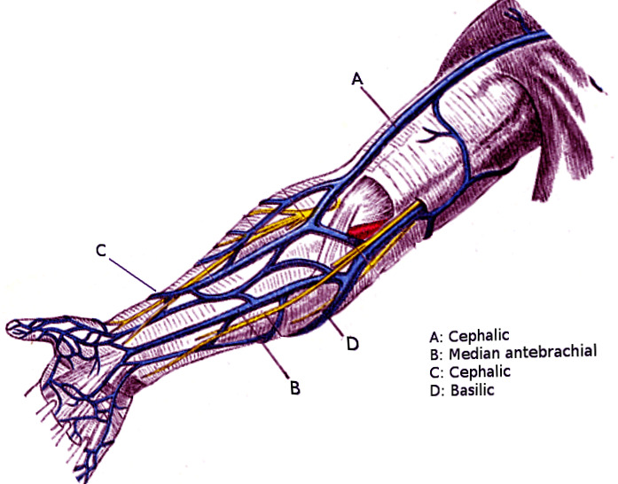 Figure, Ulnar nerve pathway Image courtesy O.Chaigasame] - StatPearls -  NCBI Bookshelf