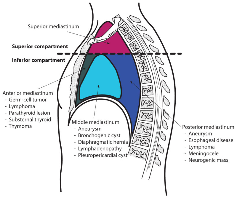 anterior mediastinum anatomy