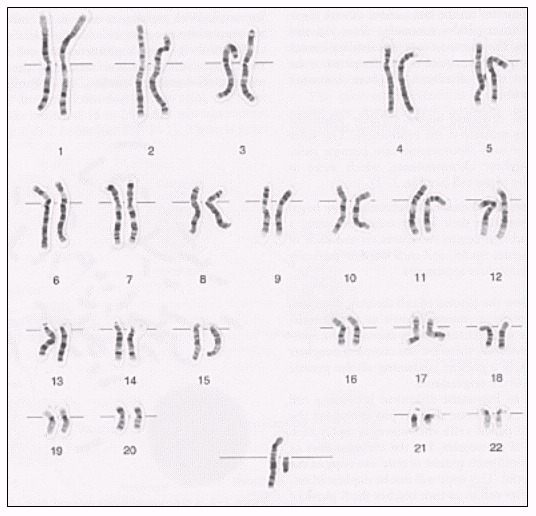 Which Chromosomes Are Shown On A Karyotype Autosomal Or Sex Telegraph 8014