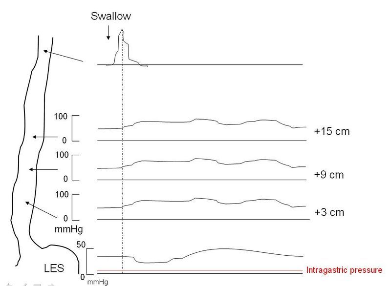 Figure, Figure 3 - The global] - StatPearls - NCBI Bookshelf