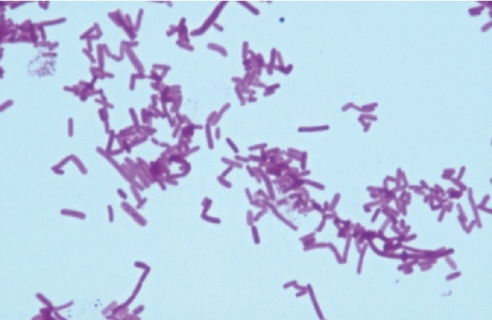 Figure 5. Gram stain of Salmonella typhimurium - Harnessing the Power ...