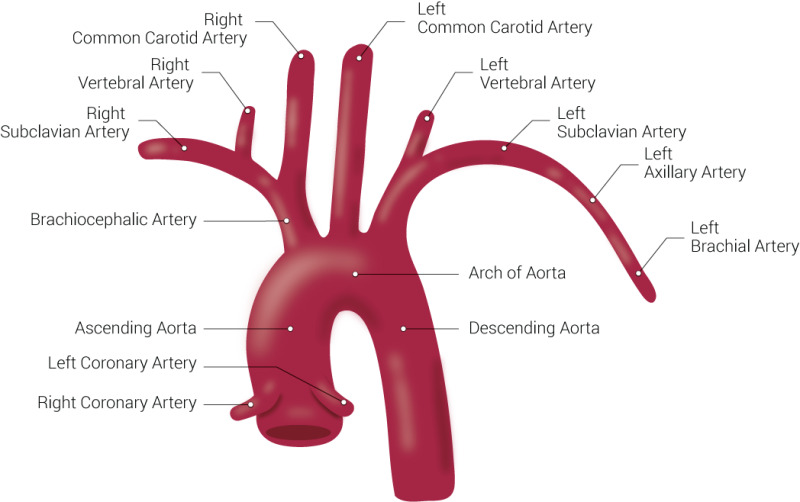 Anatomy Abdomen And Pelvis Abdominal Aorta Statpearls Ncbi Bookshelf