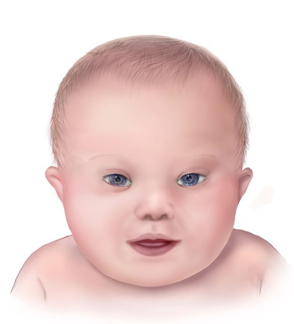 [Figure, A drawing of the facial...] StatPearls NCBI Bookshelf