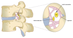 Sagittal schematics showing the location of the dorsal root ganglion (DRG) and proximal nerve roots in the spinal foramen (left) and a representation of the many foraminal ligaments (right)