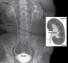 Labeled x-ray image and illustration of kidneys, ureter, bladder and abdomen