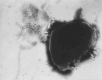 Paramyxovirus Virion Under Transmission, Electron Microscope