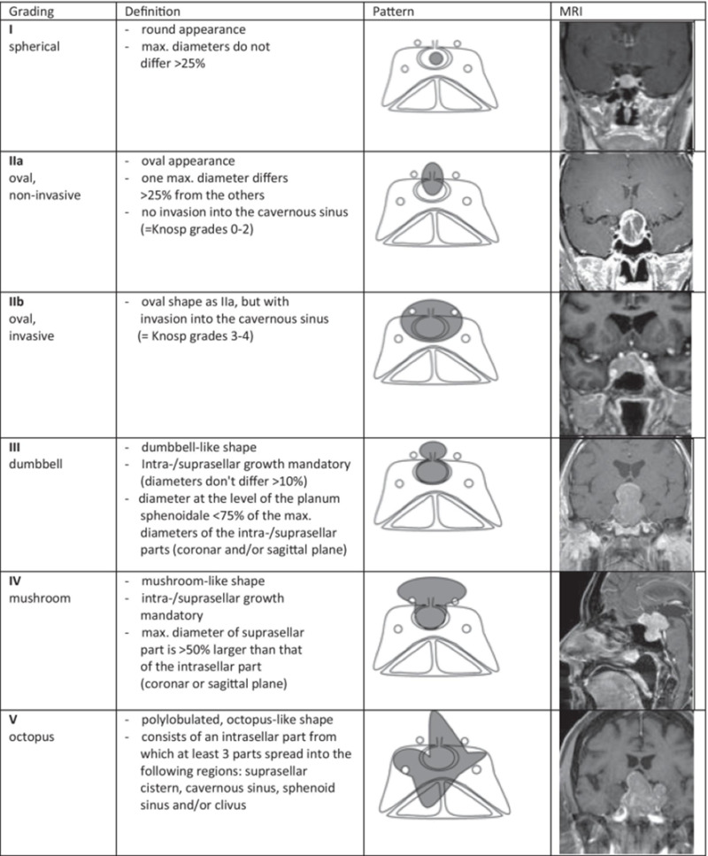 non functioning pituitary adenomas endotext ncbi bookshelf