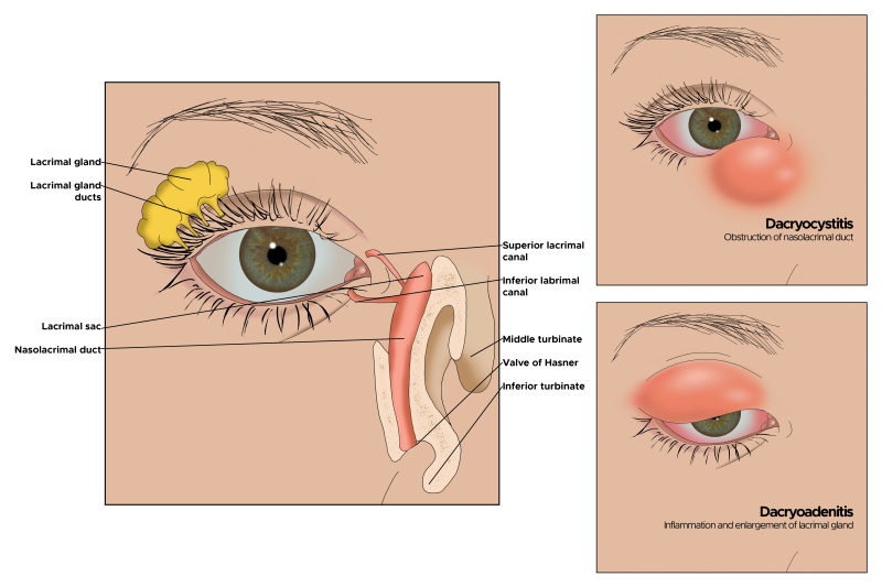 Figure, Illustration of eye. Lacrimal gland...] - StatPearls - NCBI  Bookshelf