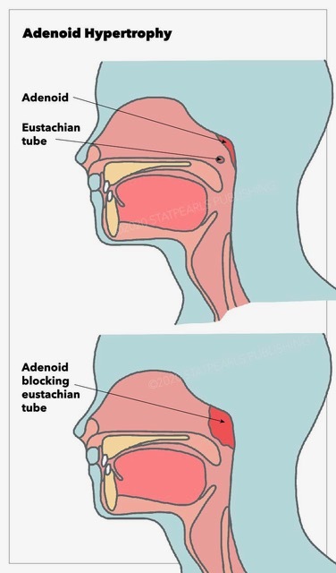 adenoid anatomy