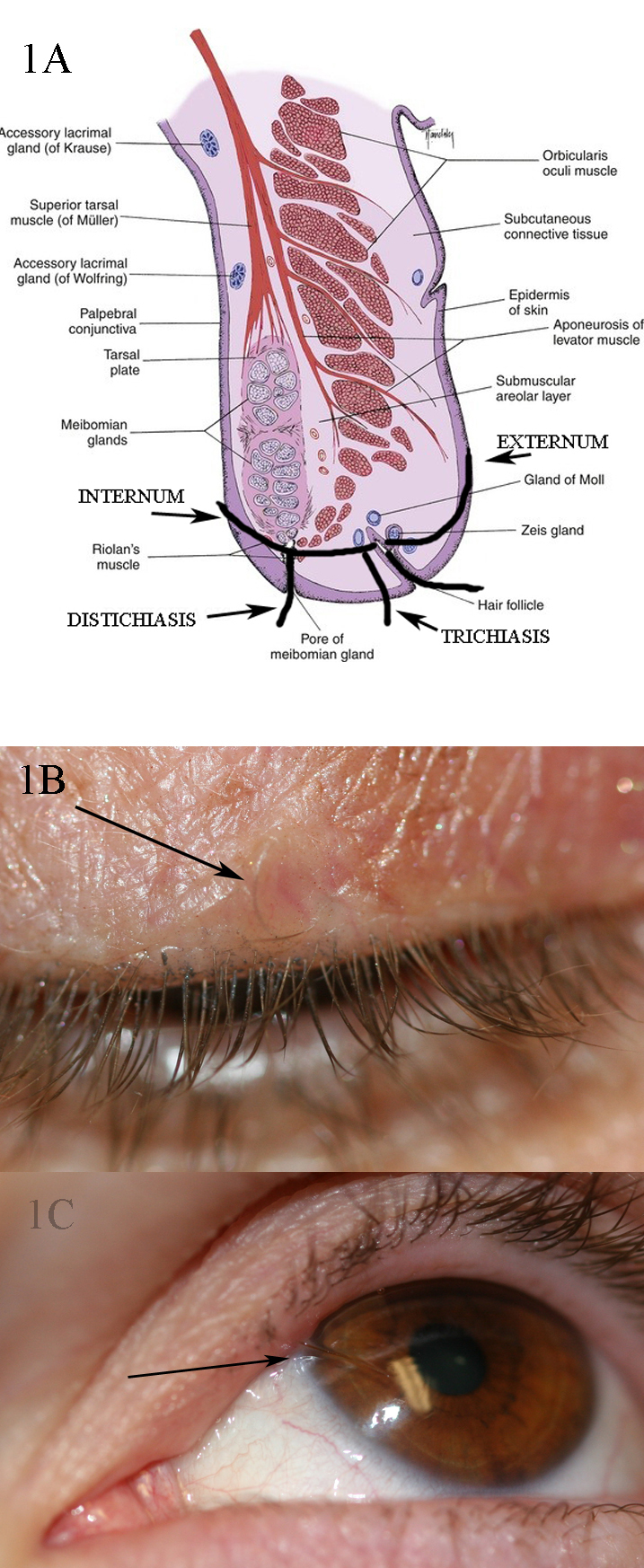 [figure 1a Shows The Different Orientations ] Statpearls Ncbi Bookshelf