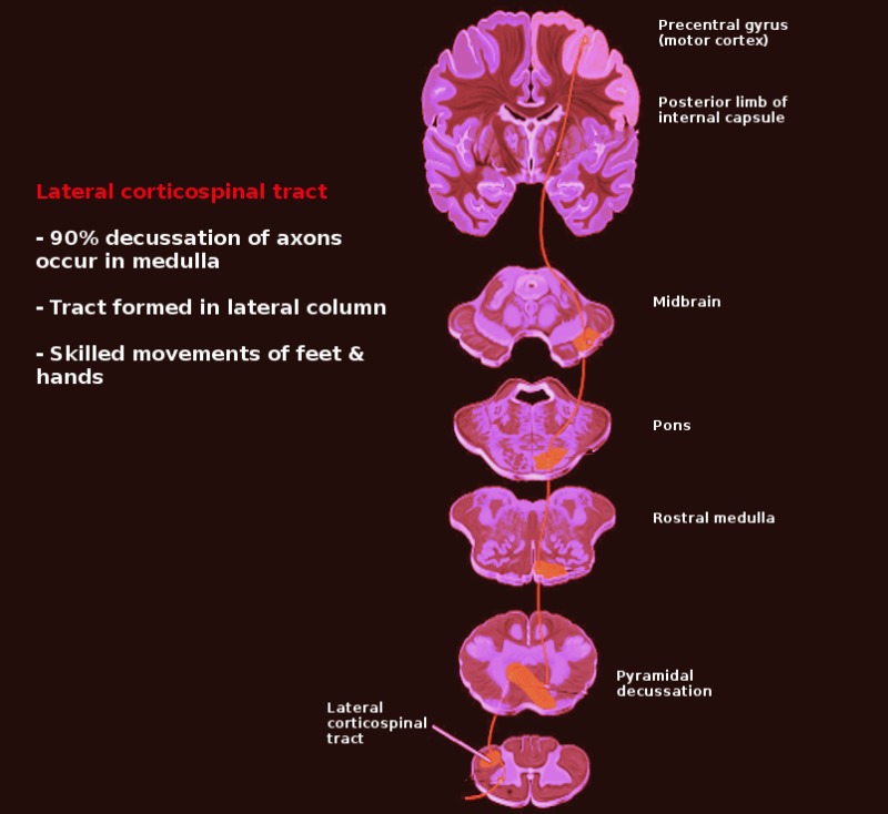 Neuroanatomy Pyramidal Tract Lesions Statpearls Ncbi Bookshelf