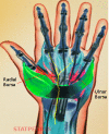Figure, Cubital tunnel syndrome Image courtesy S Bhimji MD] - StatPearls -  NCBI Bookshelf