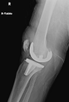 Figure, Pelvic bones Image courtesy O.Chaigasame] - StatPearls
