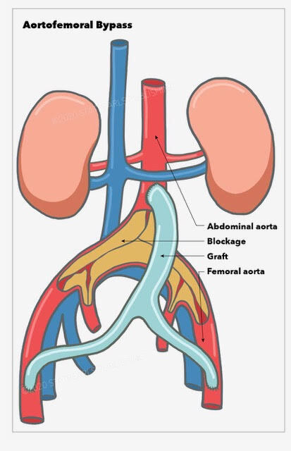 stomach aorta