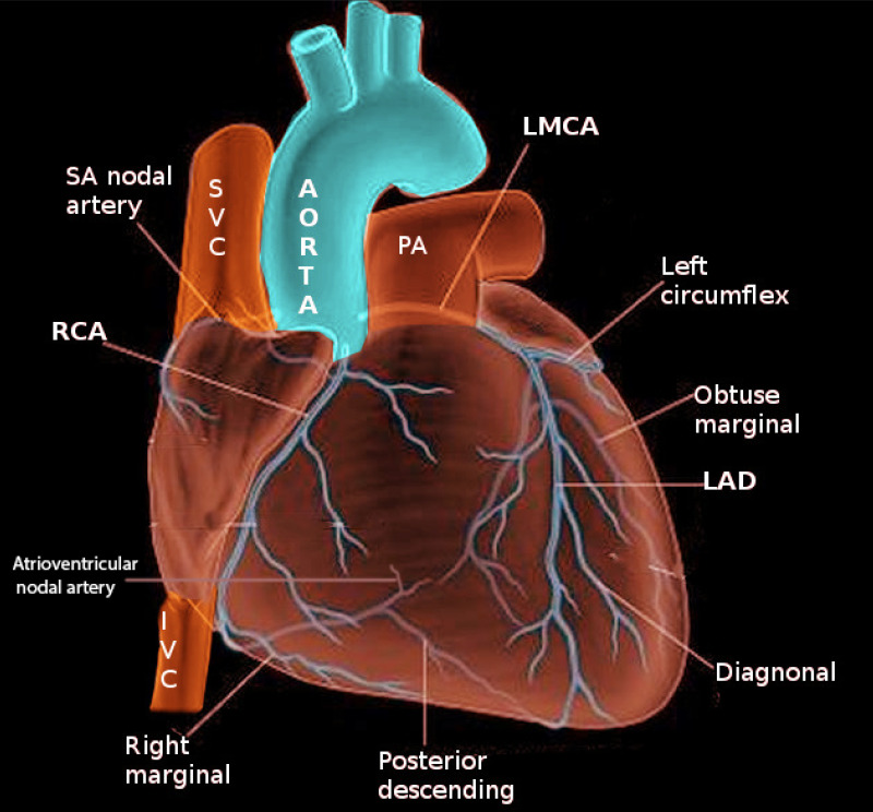 Figure Coronary Arteries Image Courtesy S Bhimji MD StatPearls NCBI Bookshelf