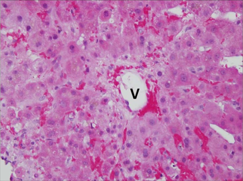 liver histology sinusoids