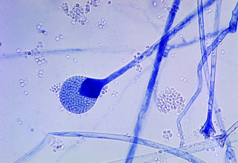 Figure 4 from Fungal Infections From Human and Animal Contact