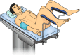 Fig. 12.4. Lithotomy position: During procedure, the surgeon gains good access to the perineal region.