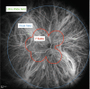 Fig. 2.13. Indocyanine green angiography in a healthy eye showing the 7-standard fields, the wide field and the ultra-wide field areas.