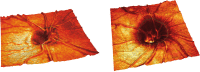 Fig. 2.8. ONH topography displayed as 3D surface for better visualization.