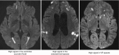 Fig. 6.4