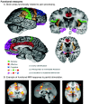 Regions of the cerebral cortex associated with pain