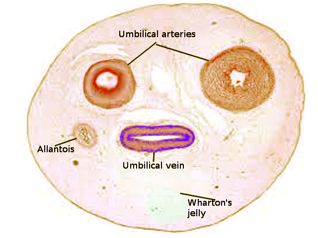 Anatomy Abdomen And Pelvis Umbilical Cord Statpearls Ncbi Bookshelf