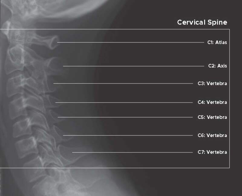 cervical spine x ray positioning