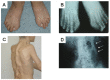 Figure 1. . Characteristic features of FOP.