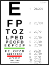 A Snellen eye chart for visual acuity testing