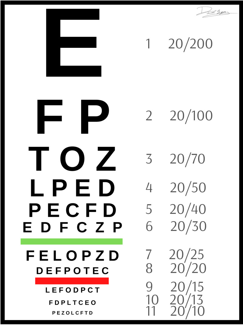 [Figure, A Snellen eye chart for visual acuity testing. Contributed by ...
