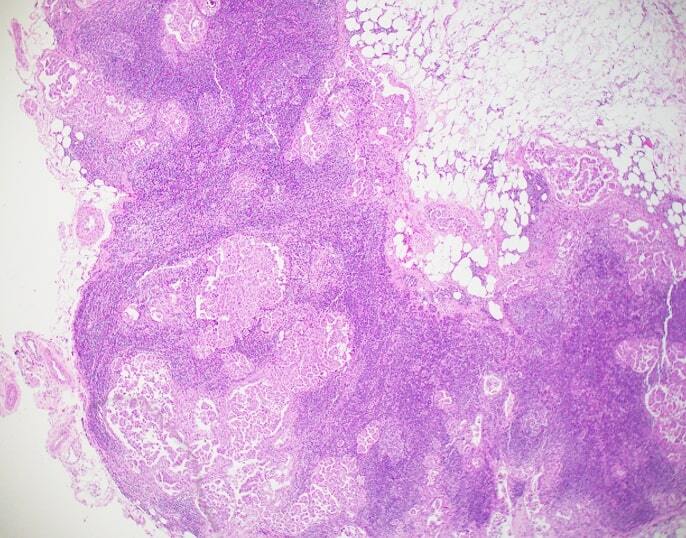 lymph node histology drawing