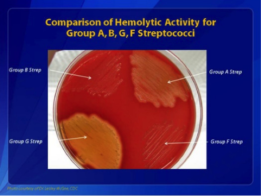 Comparisons of Hemolytic Activity for Groups A, B, G, and F Streptococci