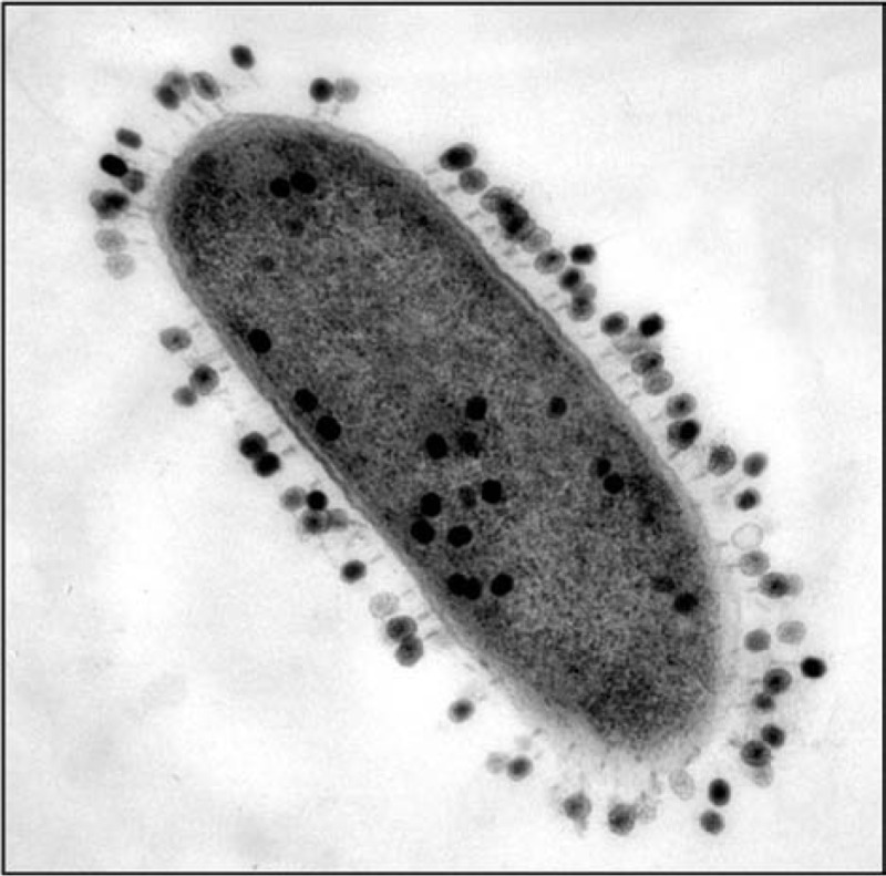 e coli bacteria