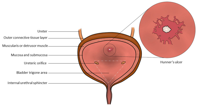 Urinary bladder mucosa stock photo. Image of histology - 117239608