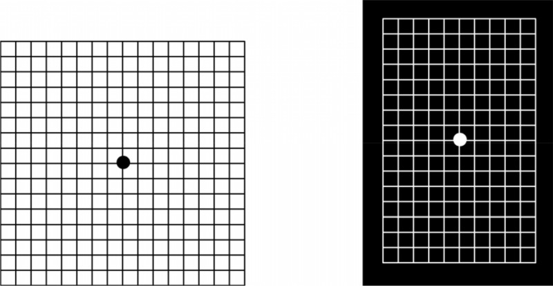 [Figure, Amsler Grid Test]. - Substance Abuse Treatment for Persons ...