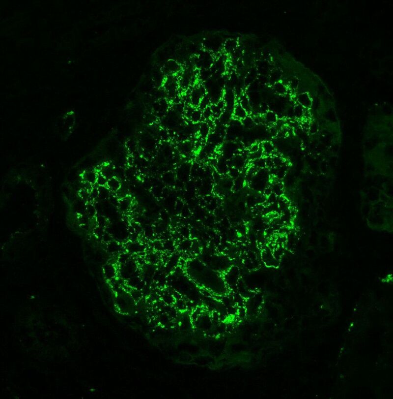 Figure Immunofluorescence Staining For C In Streptococcus Pyogenes Basic Biology To