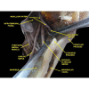 Anatomical dissection showing the lingual nerve