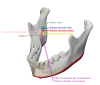 Conventional inferior alveolar nerve block Contributed and Modified from: BodyParts3D/Anatomography, CC BY-SA 2