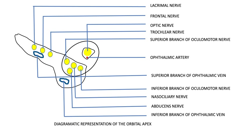 superior orbital fissure sphenoid