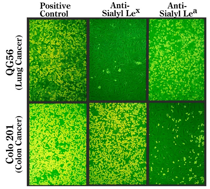 Figure 1: . Nonstatic monolayer cell adhesion assay using human cancer cells and recombinant IL-1β-activated human umbilical vein endothelial cells.