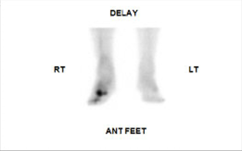 Figure Three Phase Bone Scintigraphy Bone Phase Statpearls Ncbi Bookshelf 9693